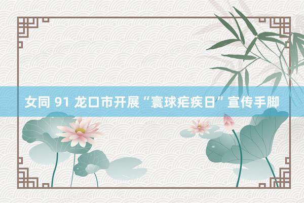女同 91 龙口市开展“寰球疟疾日”宣传手脚
